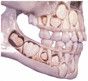 skull with baby teeth